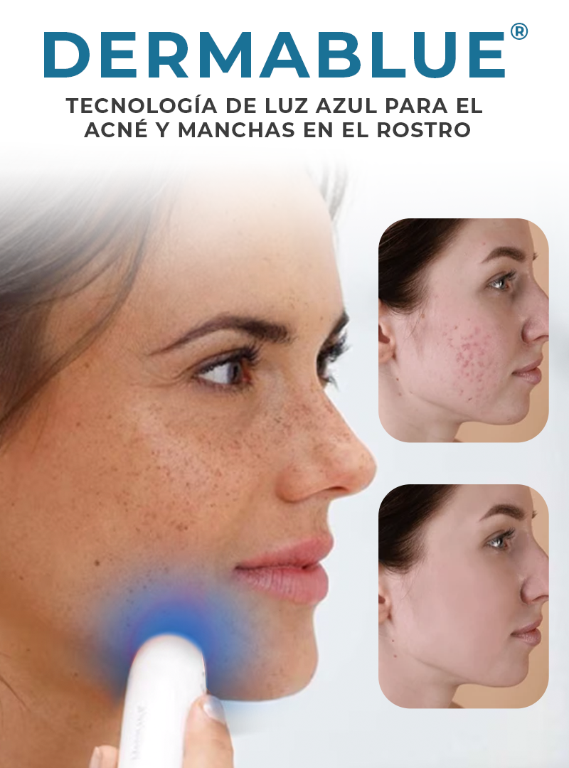 DERMABLUE®