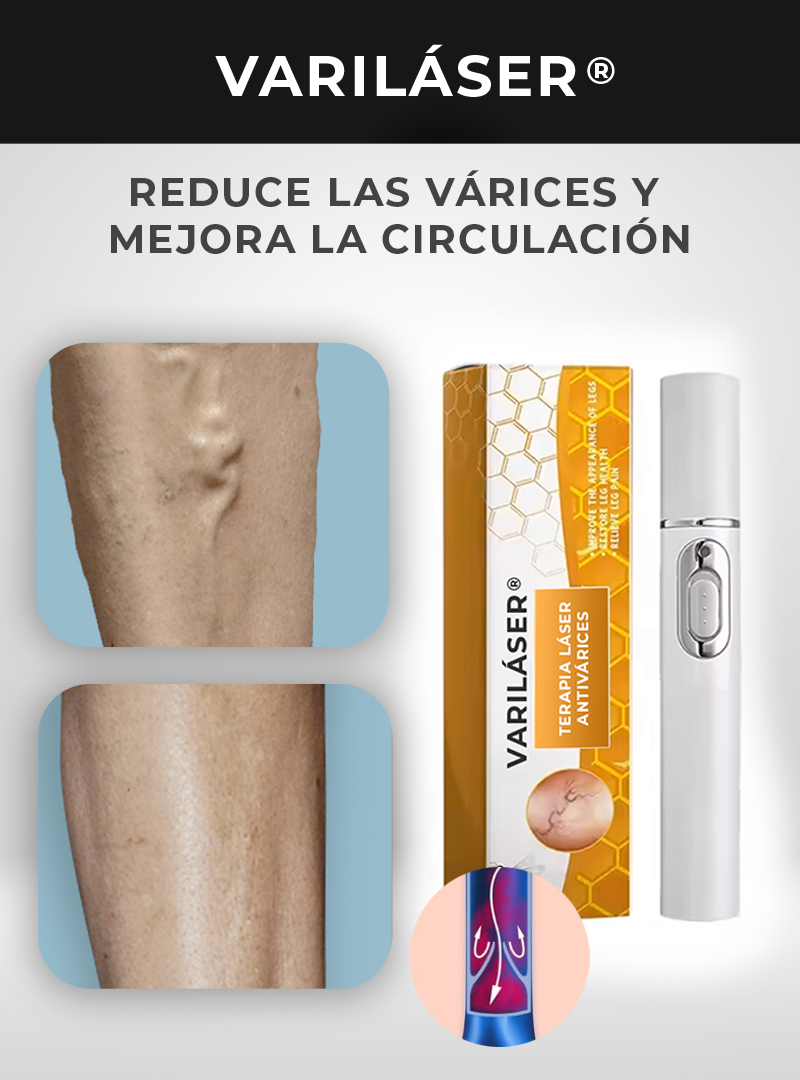 VARILÁSER ®