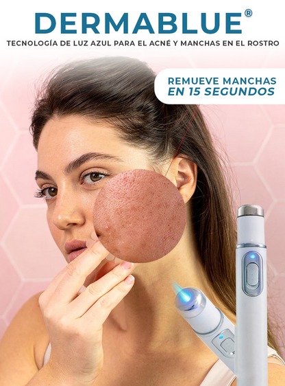 DERMABLUE®