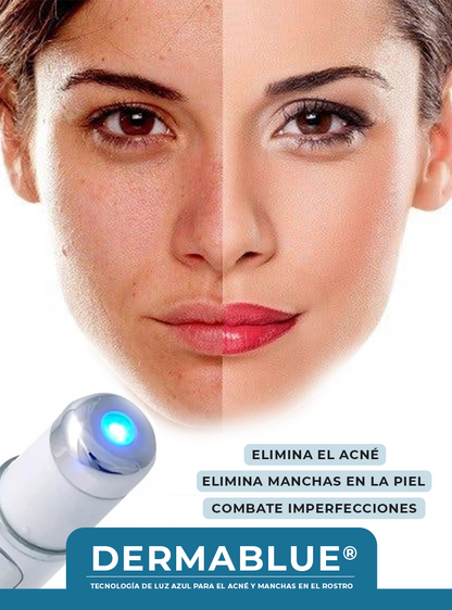 DERMABLUE®